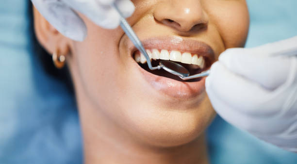 Best Emergency Tooth Extraction in El Sobrante, CA